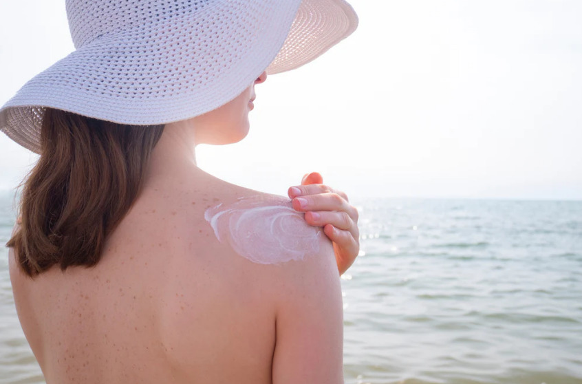 Preventing Sunburns